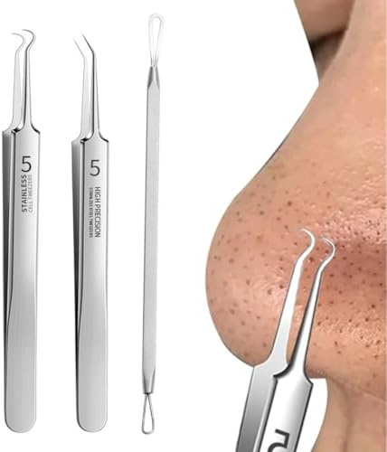 Kit Professionale per la Rimozione di Punti Neri e Comedoni, 3 Pezzi con Pinzette e Lancetta in Acciaio Inossidabile per Pulizia del Viso