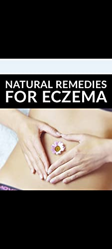 Natural Remedies for Eczema: Simpal setup to heal yourself health care