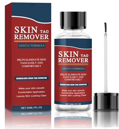 Quita Verrugas-30ml, Verrugas Quitar, Skin Tag Remover, Eliminar Verruga, Wart Remover para La Mayoría de Las Partes Del Cuerpo, Rápida y Eficaz,Suave y seguro