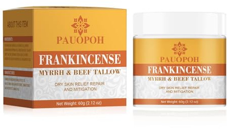 PAUOPOH Frankincense Balm – Nourishing Body Moisturizer for Dry Skin, Hands & Heels – Silky Texture, Non-Greasy, Essential Oil Blend for All Skin Types