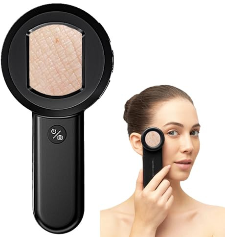 Dermatoscopio digitale palmare analizzatore 100X pelle capelluto fotocamera 16MP display LCD 2 pollici luce UV+bianca microscopio portatile per follicolo