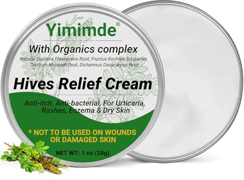 Crema calmante para urticaria, tratamiento rápido antifúngico y antipicazón para erupciones alérgicas, eccema, picazón, rojez e hinchazón | Complejo herbal orgánico natural, 28 g