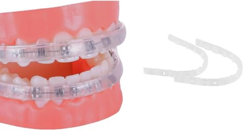Protector de labios para brackets, protector bucal ortodóntico para brackets, alternativa a la cera, fundas cómodas para brackets, protector labial para brackets, tope labial para brackets