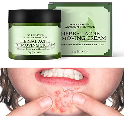 Tongyend Acne Cream,Moisturiser Face Cream Spot Cream Mens Moisturiser Tea Tree Cream Spot Cream Acne Cream Moisturiser Women Men Teenagers Dilute Face Prone Spot Marks Balance Facial Oil Cream