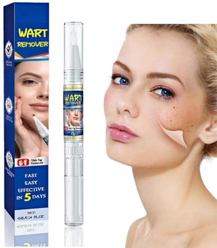 Wart Remover Pen,Tags and Mole Remover Pen,Effective Remover for Tag,Gentle and Safe Skin Tag Remover Liquid,Skin Wart Rem-Over Pen for Face,Body and Hands,Natural Wart Rem-Over for All Sk-in Types