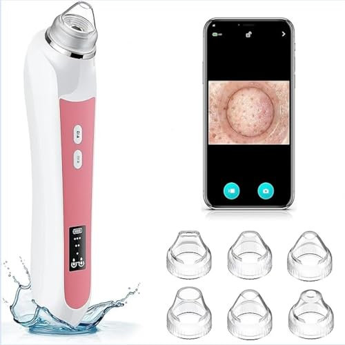Aspirateur de points noirs : outil de nettoyage intelligent des pores avec chargement USB - Caméra haute définition intégrée - 3 niveaux de 6 têtes de nettoyage - Modèle unisexe (rose)
