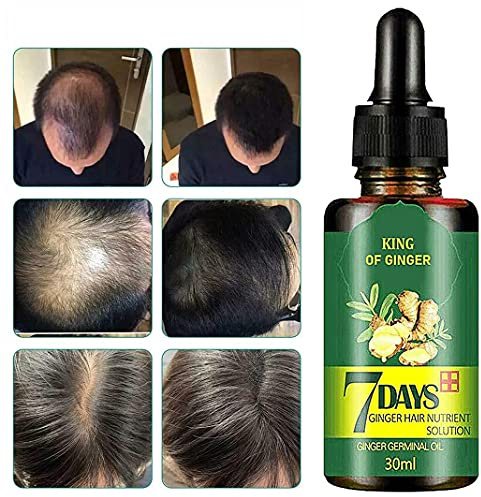 MoriAction Advanced Hair Booster, Haarnachwachsen 7 Tage Ingwer Keimhaarwachstumsserum Friseurölverlust, Haarpflegeessenz für Männer & Frauen 30ML