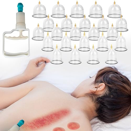 24er Set Schröpfgläser mit Vakuumpumpe – Kunststoff-Schröpfset für Schröpftherapie – Inklusive Magneten zur Muskel- und Nackenbehandlung – Effektive Schmerztherapie für Zuhause