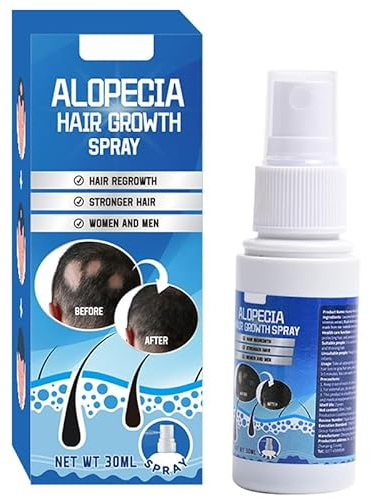 Hair Growth Serum Spray, Effective Hair Thickening and Hair Loss Treatment for Stops Hair Loss, Promotes Thicker Rosemary, and Castor Oil, Fuller Hair For Women & Men