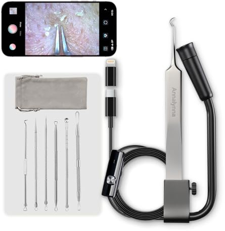 Luma 1 Pince Extractrice de Points Noirs avec Caméra – Outil Anti-Boutons avec Grossissement 20x, 1080P, 8 Lumières LED, avec Kit Extracteur de Points Noirs (Ensemble 6 Pièces), Noir