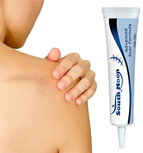 Tebinzi Gel per cicatrici, cicatrici, crema per la rimozione di cicatrici per viso e corpo, trattamento nutriente per cicatrici chirurgiche, sezione C, ustioni, cheloidi e cicatrici ipertrofiche