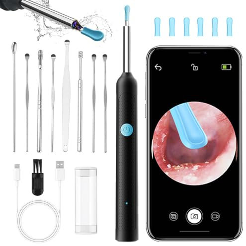 QILUCKY Ear Wax Removal Kit, Wireless Ear Cleaner with Camera 1920P HD, WiFi Otoscope with 6 LED Lights & 8 Ear Spoons, Earwax Remover Tool for Camera for iPhone Android Phones (Black)