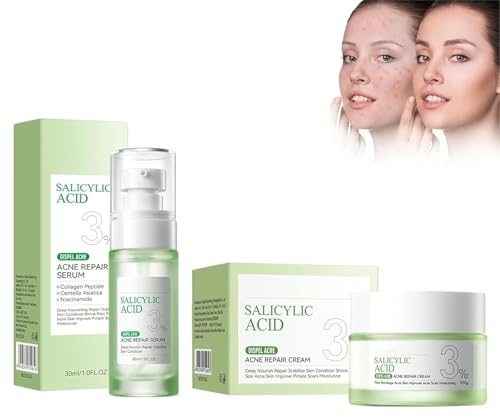 Kit De Cuidado Facial Con Ácido Salicílico, Suero Anti-Acné Y Crema Hidratante, Trata Efectivamente El Acné Y Las Espinillas, Limpia Y Minimiza Los Poros Dilatados, Controla El Exceso De Grasa