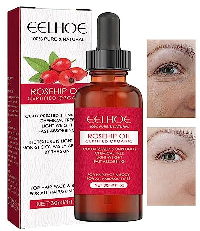 Kirdume musquée Biologique | Huile Visage Bio à la musquée pressée à Froid - Huile Essentielle du Visage pour hydrater Le Visage, 30 ML d'Massage la Peau pour Les