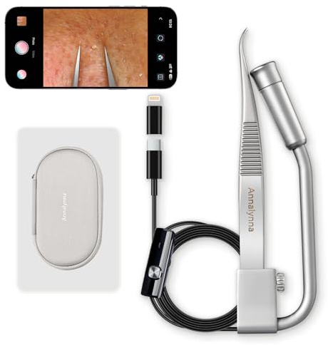 Luma 1 Pinzas Quitapuntos Negros con Cámara – Pinzas con Cámara, Aumento 20x, 1080P, 8 Luces LED, Diseño de Delfín, Acero Inoxidable No Magnético, Limpiador de Poros