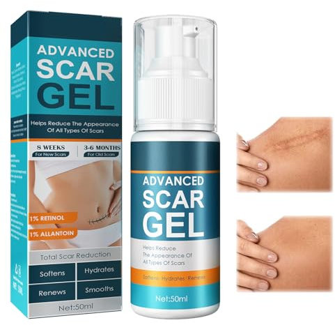 ARZER Narbengel, Silikon-basiert, Gel, Narben-Creme, 50 ml