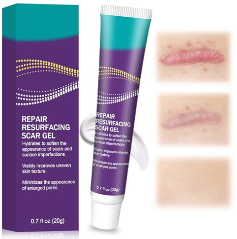 20g Cicatrici Crema,Gel crema Riparatore,Gel Trattamento per la pelle Per uomini e donne,Riparazione della pelle crema uso quotidiano,Ideale Per tutte le parti del corpo