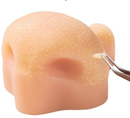 Reusable Pimple Poppings Toy Nose, Silicone Pimple Poppers Squeeze Stress Toy, Stress Relief Zit Poppings Toys Realistic Blackhead Game For Adults Kids Girls With Strawberry NoseTweezers