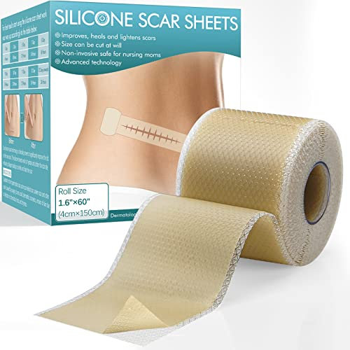 Silikonpflaster für Narben, Easy-Tear Silikon-Narbenblätter, Narbensalbe für Narben, die durch Kaiserschnitt, Operationen, Verbrennungen, Keloid usw. verursacht wurden (150cm)