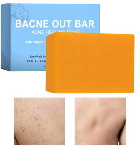 Bacne Out Bar - 100g Saponetta Per La Pulizia Profonda Dei Pori Con Curcuma, Vitamina C E Alfa-arbutina, Trattamento Naturale Contro L'acneCorporea Per Schiena, Petto E Spalle,Rimozione Macchie Scure