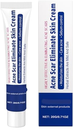 Kräuter-Akne-Clearing-Creme – Ölkontrolle, Sanfte Porenreinigung, Feuchtigkeitsspendende Und Beruhigende Gesichtscreme For Reinere Haut(3PCs)