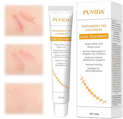 20g Scar Repair Cream, Hautpflege Gel, Verbesserung Des Aussehens der Haut, Schnell einziehend, Einfach Auftragen, Für Den Täglichen Gebrauch
