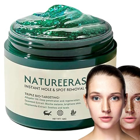 Gel per Rimozione Nevi, Schiarimento Macchie e Nei, Gel Delicato con Azione Schiarente e Riparatrice per la Cura del Viso e del Corpo, 50g per Donne, Uomini e Tutti i