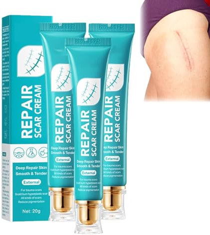 Crème anti-cicatrices pour hommes et femmes, crème réparatrice pour l'élimination des cicatrices cutanées, pommade cicatrisante pour la peau, gel lissant et raffermissant pour le visage et le corps, r