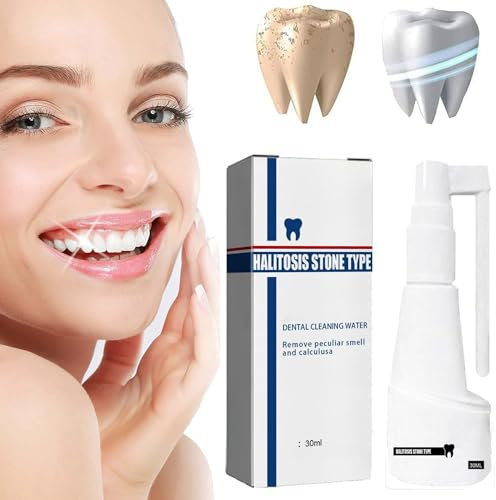 Calculusfree, spray per la pulizia del calcolo dentale, spray per collutorio dei denti, sbiancamento dei denti, spray rinfrescante per denti, rimozione tartaro (1 pezzo)