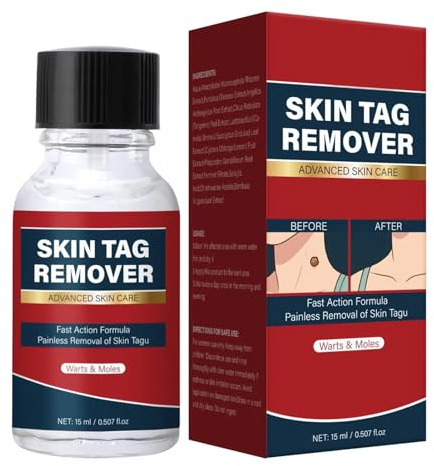 Eliminazione dei Nei, 15ml Soluzione Per La Cura Della Bellezza, Liquido per la Rimozione dei Nei, per Donne Uomini Viso Collo Schiena Spalle Mani Braccia Gambe Piedi