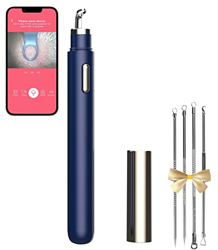 Mitesserentferner mit Kamera, WiFi Visuelle Mitesserentferner Werkzeuge mit Weiß/Blauen Lichtern für iPhone, Android Handys Frauen Geschenk