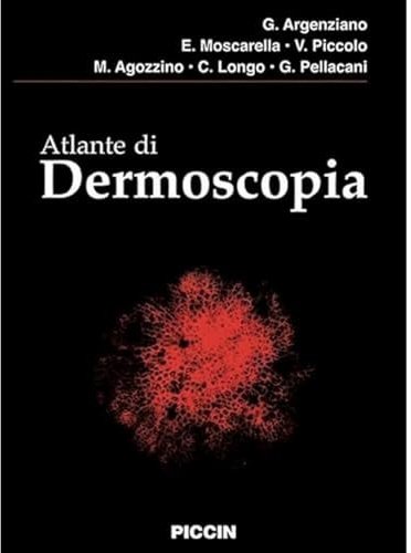 Atlante di dermoscopia