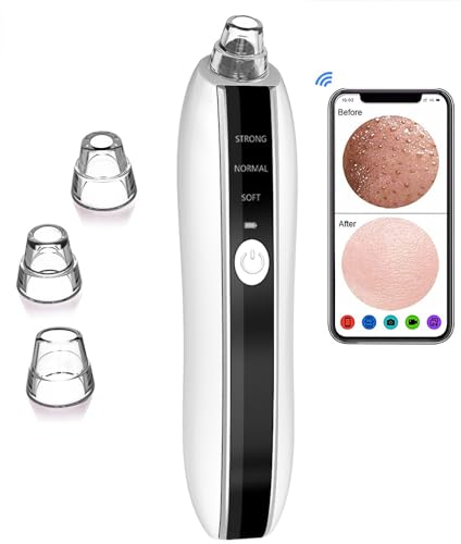 ZHENGE Aspirateur de points noirs intelligent, outil de retrait de points noirs avec caméra HD 1080p, aspirateur de pores de type port USB, nettoyeur de pores pour homme et femme, têtes d'aspiration