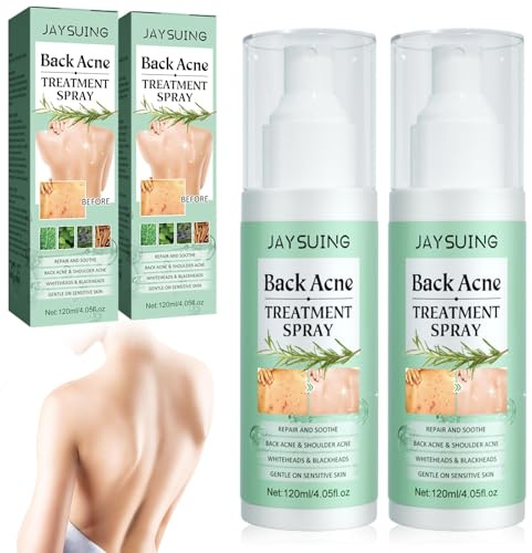 2 PCS Torna Soluzione Brufolo, Acne Spray Back And Chest, Schiarire i segni dell'acne, Esfoliante schiena Pulizia profonda per corpo, delicato sulla pelle, Pulizia Profonda per Tutti i Tipi di Pelle