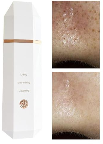 Espátula de limpieza profunda para la piel, espátula facial para exfoliar la piel, limpiador ultrasónico de poros, extractor de comedones, limpiador de poros de agua recargable inalámbrico resistente