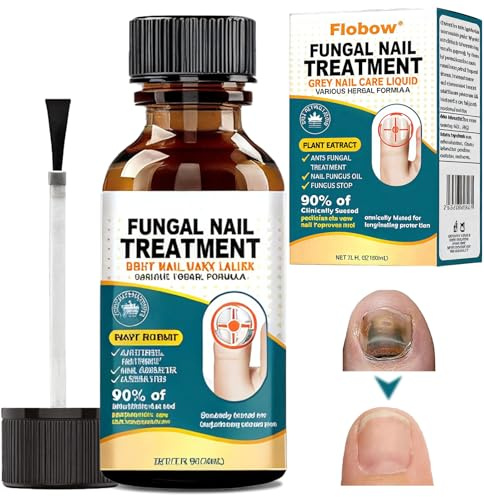 30ml Liquido Riparatore Cura Delle Unghie, Soluzione per La Riparazione Delle Unghie Dei Piedi, Soluzione per la Cura Delle Unghie,Dell'unghia Nutre e Riparare Le Unghie Danneggiate