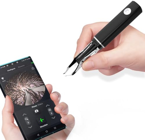 Scopepickeu Visuelle Haarentfernungs-Pinzette mit 1080p Kamera & LED-Licht – WLAN-fähige, USB-wiederaufladbare Präzisionspinzette für weiße Haare, Ohrhaare, Augenbrauen & Wimpern