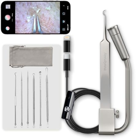 Luma 1 Pince à épiler Visuel avec Appareil Photo - Outil de Popper Pimple Popper avec Appareil Photo Grossissement 20x, 1080p, 8 Lumières LED, avec Extracteur de Points Noirs et Boutons Kit (6 Pièces
