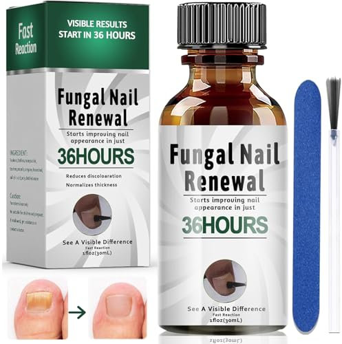 30ML Nagelpflege und Behandlung, Nagelaufbauserum mit Nagelfeile, NägelReparatur, Nagelpflege pflegend, Nail Essence Serum für Gebrochene und Verfärbte Fingernägel und Fußnägel, Nagelpflegeöl