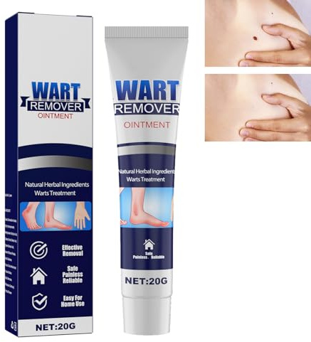 Pommade Anti-verrues,Crème Anti-étiquettes Cutanées,Crème D'élimination Instantanée des Verrues,Pommade Anti-verrues Skin Deluxe,Crème Anti-imperfections Instantanée