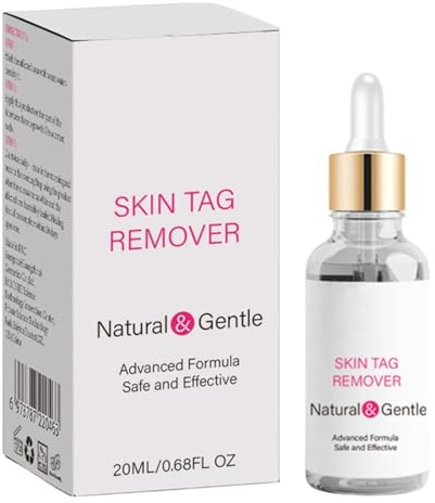Rimozione Neo Cutaneo | 20ml Trattamento Liquido per Verruche | Soluzione per Nei Cutanei,Per Uomo Donna Spalle Schiena Mani Piedi Viso Collo Braccia Gambe