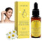 Frankincense Resina Oil for Face, Frankincense infused Face oil, Fortalecedor Anti-Arrugas Aceites, Ideal for Moisturizing, Anti Age-Defying, Relaxation, Skin Nourishment (#30ml, 1pcs)