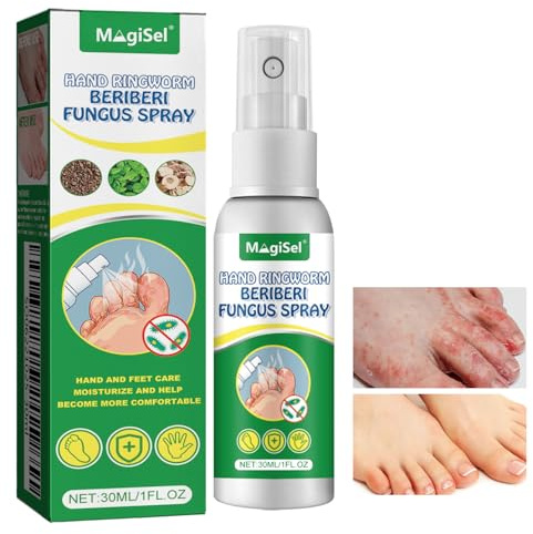 Fußpflege Spray,Fußpilz Spray für Schuhe Teebaumöl Spra-y Fußspray,Lindert Fuß, Schuh und Sockengeruch Dauerhafte Frische (30ML)