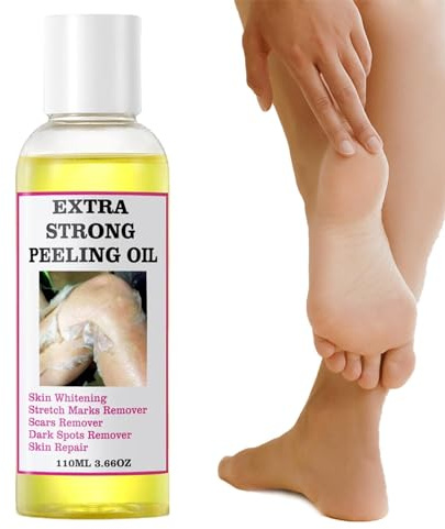 Shannan Peeling Oil For Dark Skin, 110ml Portable Body Exfoliate, Whitening Softening Callus Removal, Unisex