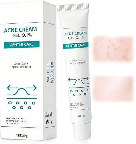 20g Crème Visage Anti-Acné, Creme Acne Visage, AméLiore Les Imperfections CutanéEs, Améliorer l'apparence de l'acné, Hydrater la peau, Convient à La Plupart Des Types De Peau