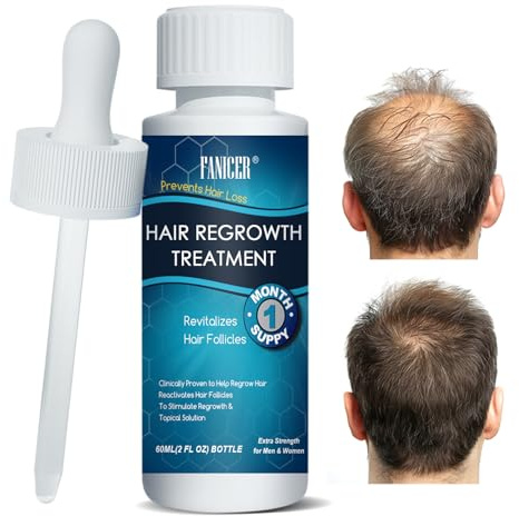 60ML Sérum Croissance des Cheveux, Stimule la Pousse, Soin Cheveux, Pour Adulte Clairsemés