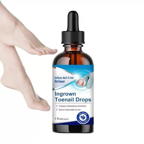 30ml Nagelpflege Flüssigkeit für Zehennägel, Nagelpflege pflegend, Fur pflege Gebrochene und Verfärbte Zehennägeln, Schutz & Stärkung Nagelhaut,gesunde Fuß und Hand