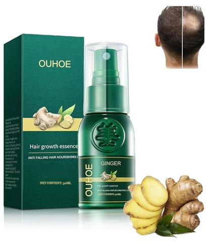 Orgrul - Spray giapponese per la crescita dei capelli, spray tonico giapponese per la crescita dei capelli, 30 ml (1 pezzo)