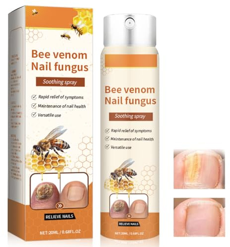Biprodukt nagelreparationsspray med bikbehandling, propolis nagelserum, naglar reparationsserum, nageltillväxt och reparationsserum för naglar och fotnaglar