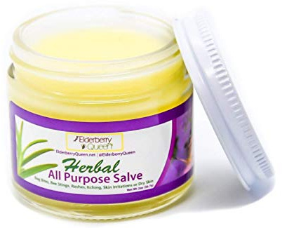 Elderberry Queen Healing Salve, All Purpose Anti Itch Herbal Balm for Dry Itchy Skin, Cracked Heels, Minor Burns, Sunburn, Chapped Lips (2 ounce)
